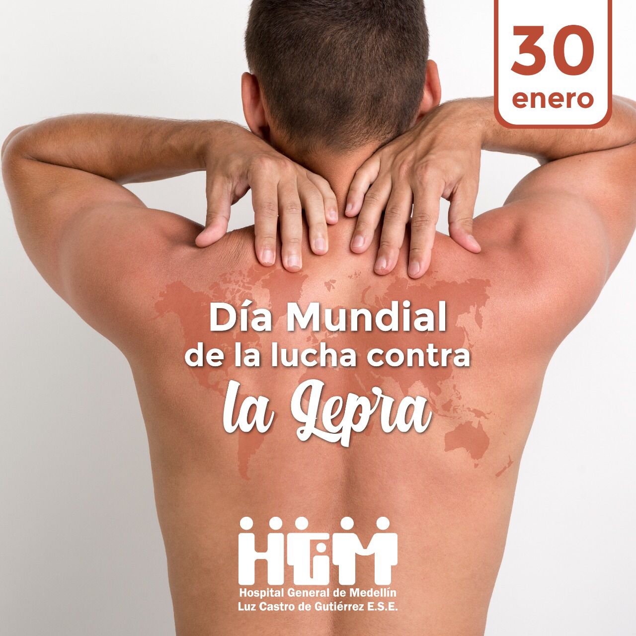 Día Mundial de la Lucha contra la Lepra