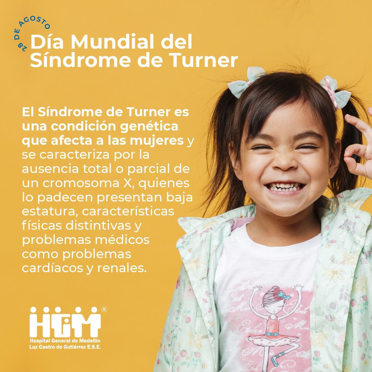 28 de agosto Día Mundial del Síndrome de Turner