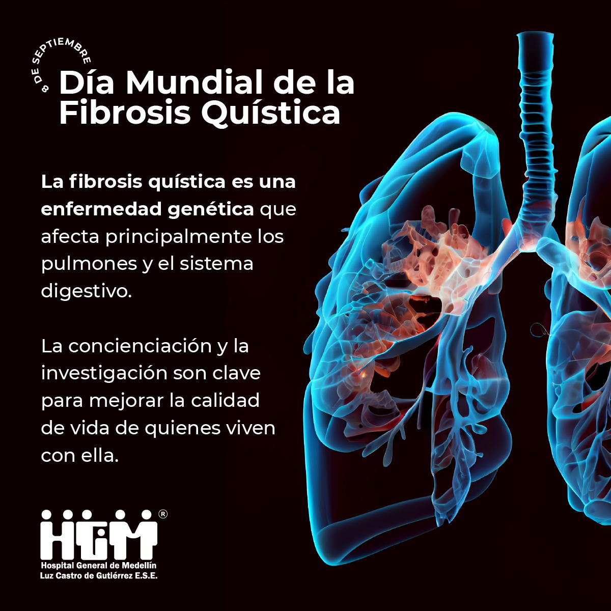 fibrosis quística